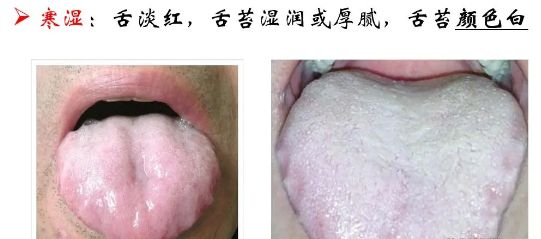 儿童秋季腹泻高发期!家长如何轻松应对?牢记4大点!