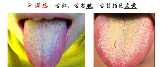 儿童秋季腹泻高发期!家长如何轻松应对?牢记4大点!